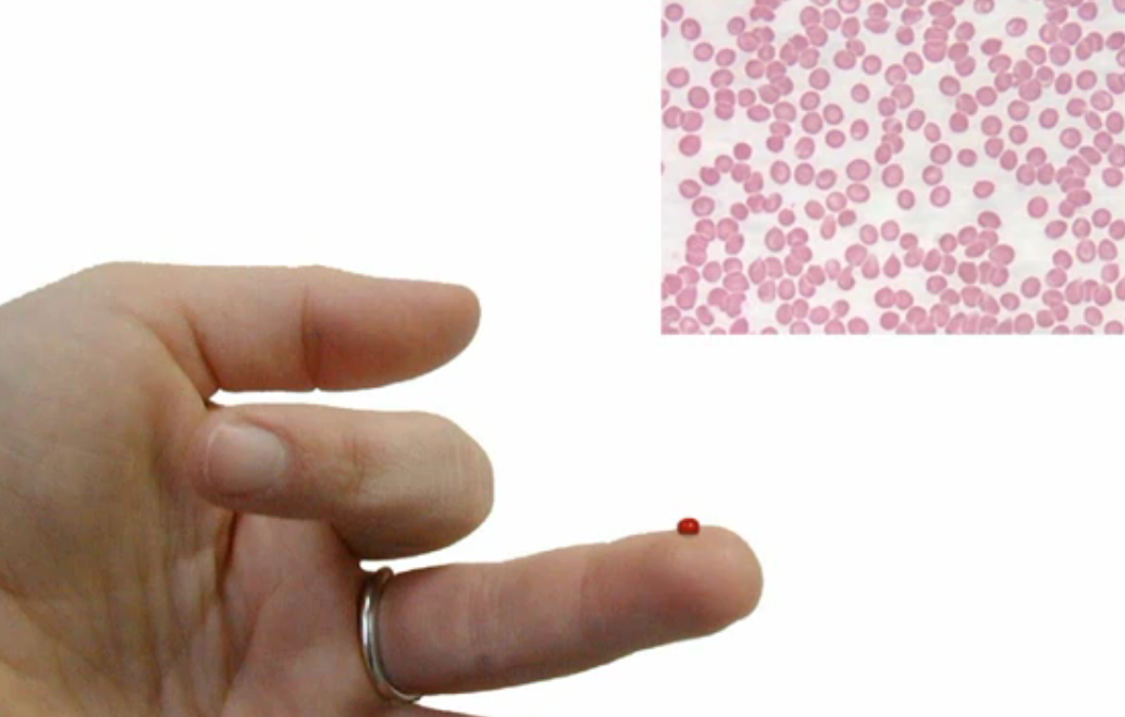 LifeLens: A smartphone app that can detect malaria
