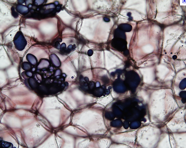SkyLight lets you connect any smartphone to a microscope