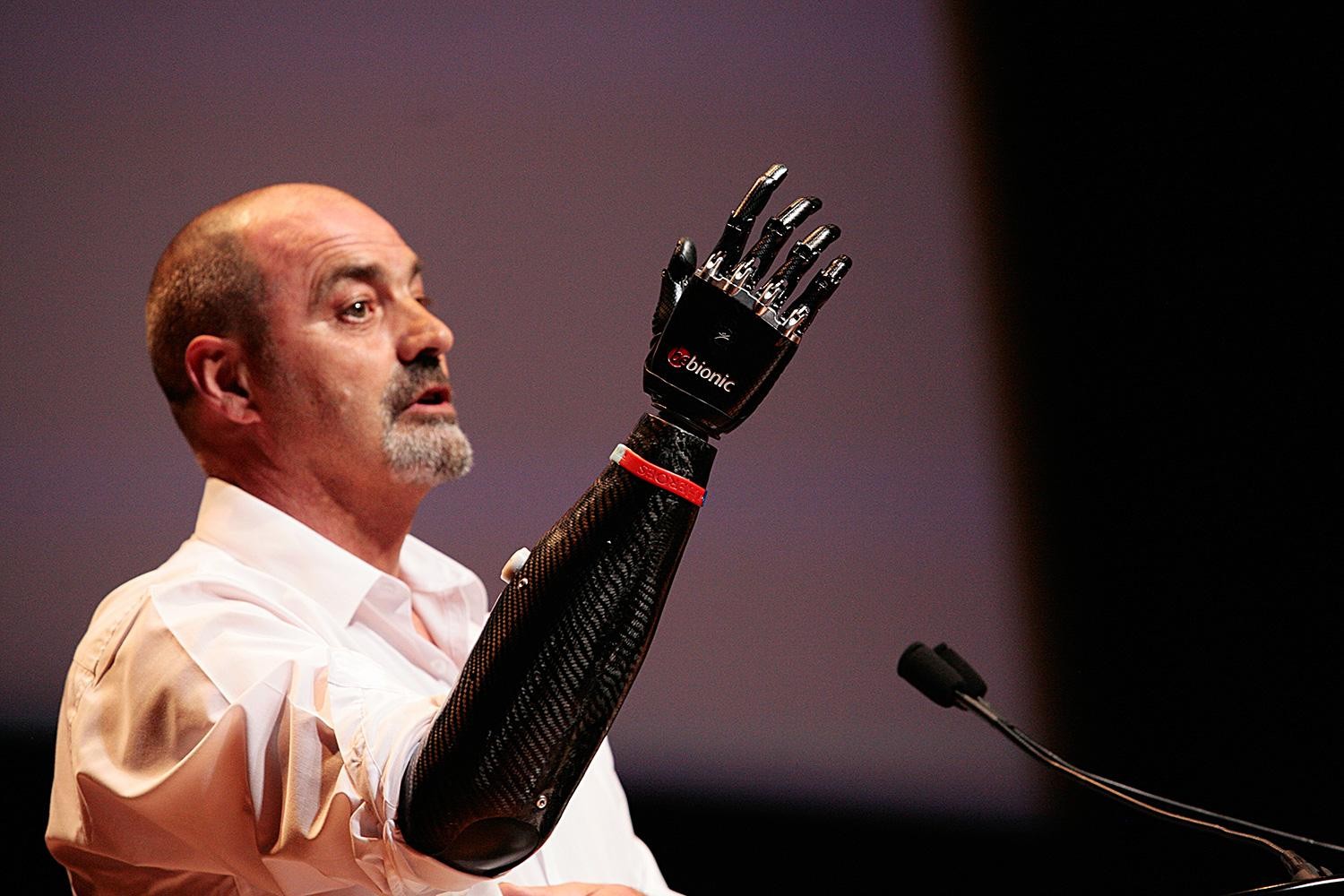 A bionic arm gives life back to a deserving man