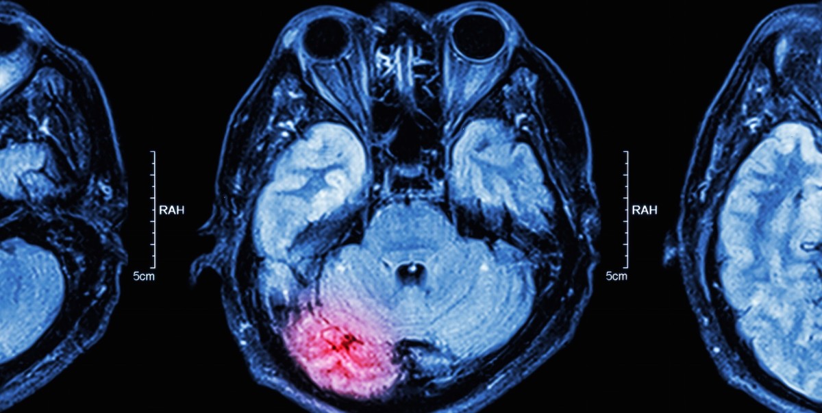 Researchers think we may have to protect our brains from hackers in a few years
