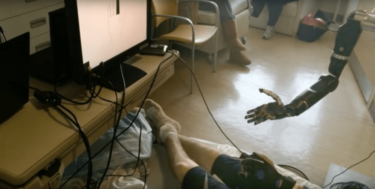 This mind-controlled prosthetic arm can control individual finger movements