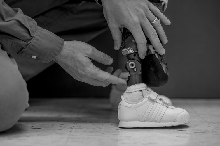 Military-funded prosthetic technologies benefit veterans, but also kids
