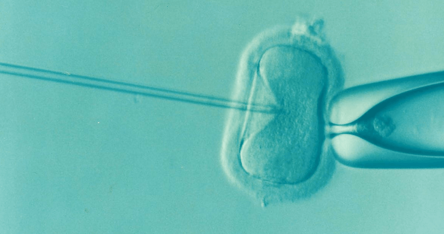 Controversial new test could be used to screen embryos for intelligence