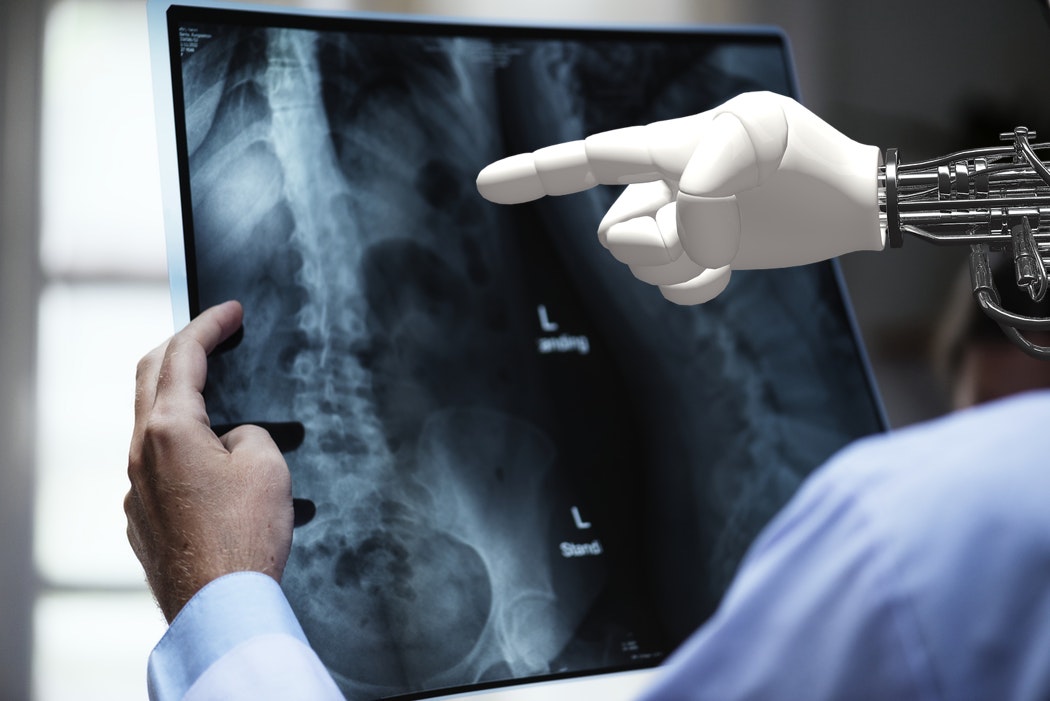 Philips devs are coding algorithms that help detect cancer accurately