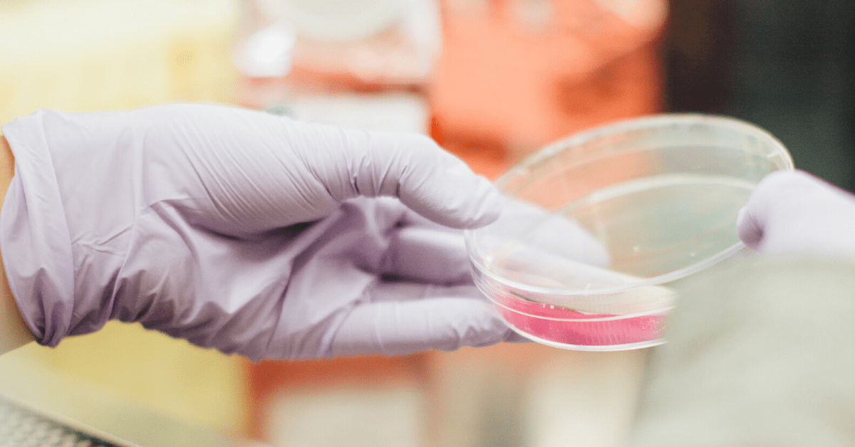 Israeli scientists discover how to trigger pancreatic cancer cells to self-destruct