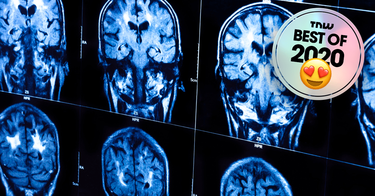 Scientists may have found the missing link between brain matter and consciousness