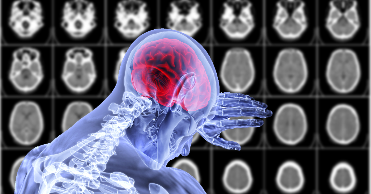 Over a third of coronavirus patients show neurological symptoms, study reports