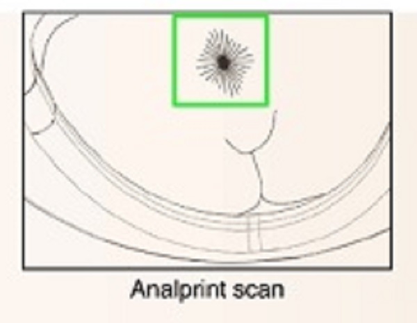 This smart toilet offers advanced poop analysis and analprinting - 69