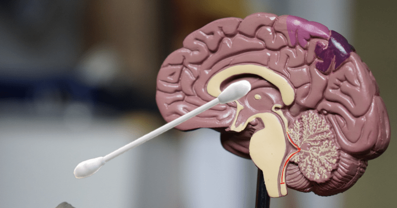 No, you can’t puncture your brain with a COVID-19 swab test