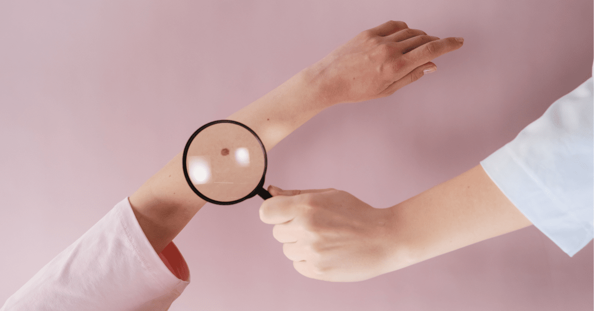 This ‘AI doctor’ can assess skin melanoma as accurately as human dermatologists