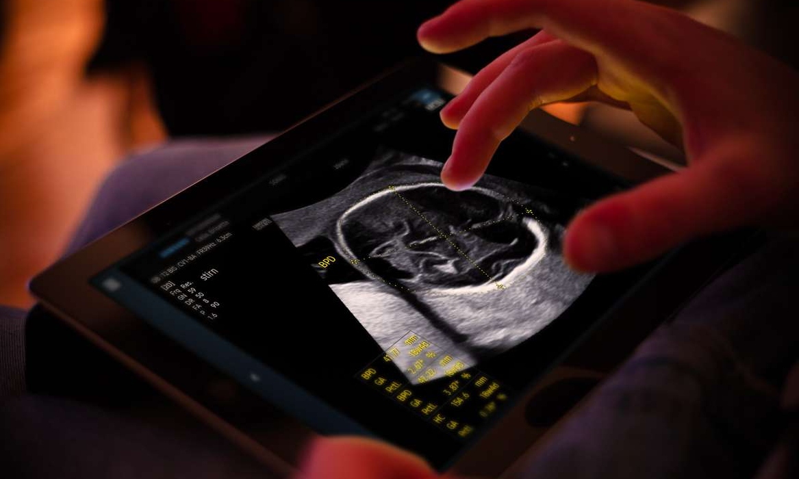 Samsung completes €86M takeover of French AI ultrasound startup Sonio